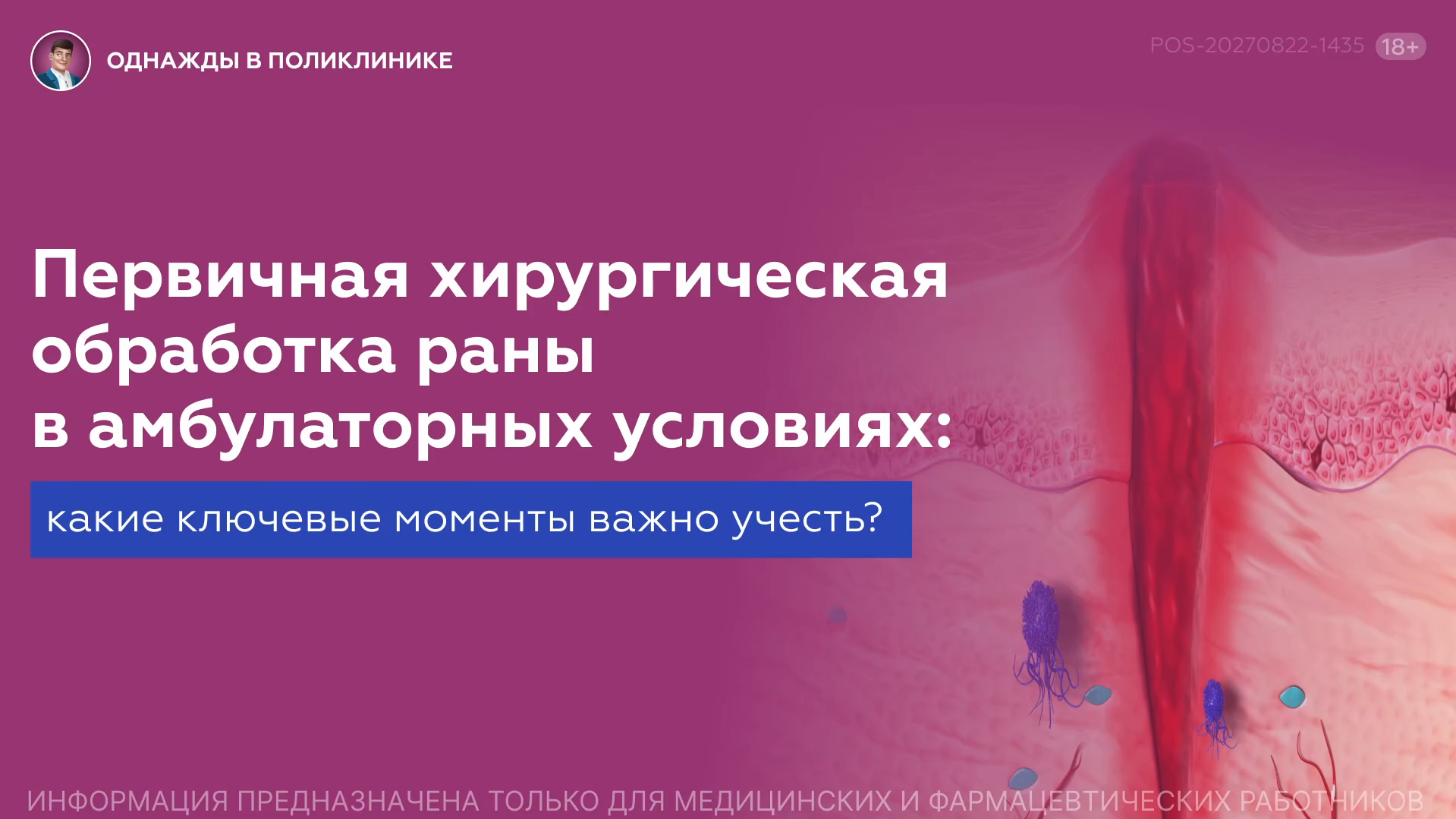 Превью видео