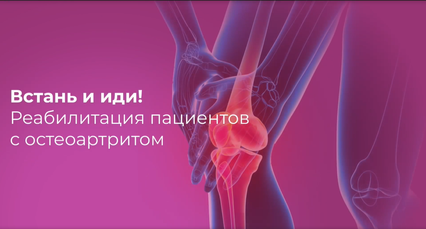 Превью видео